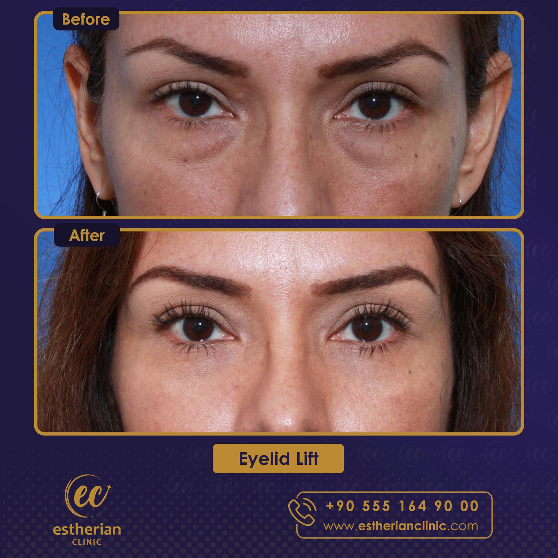 Estherian Istanbul on Esthetic Planet