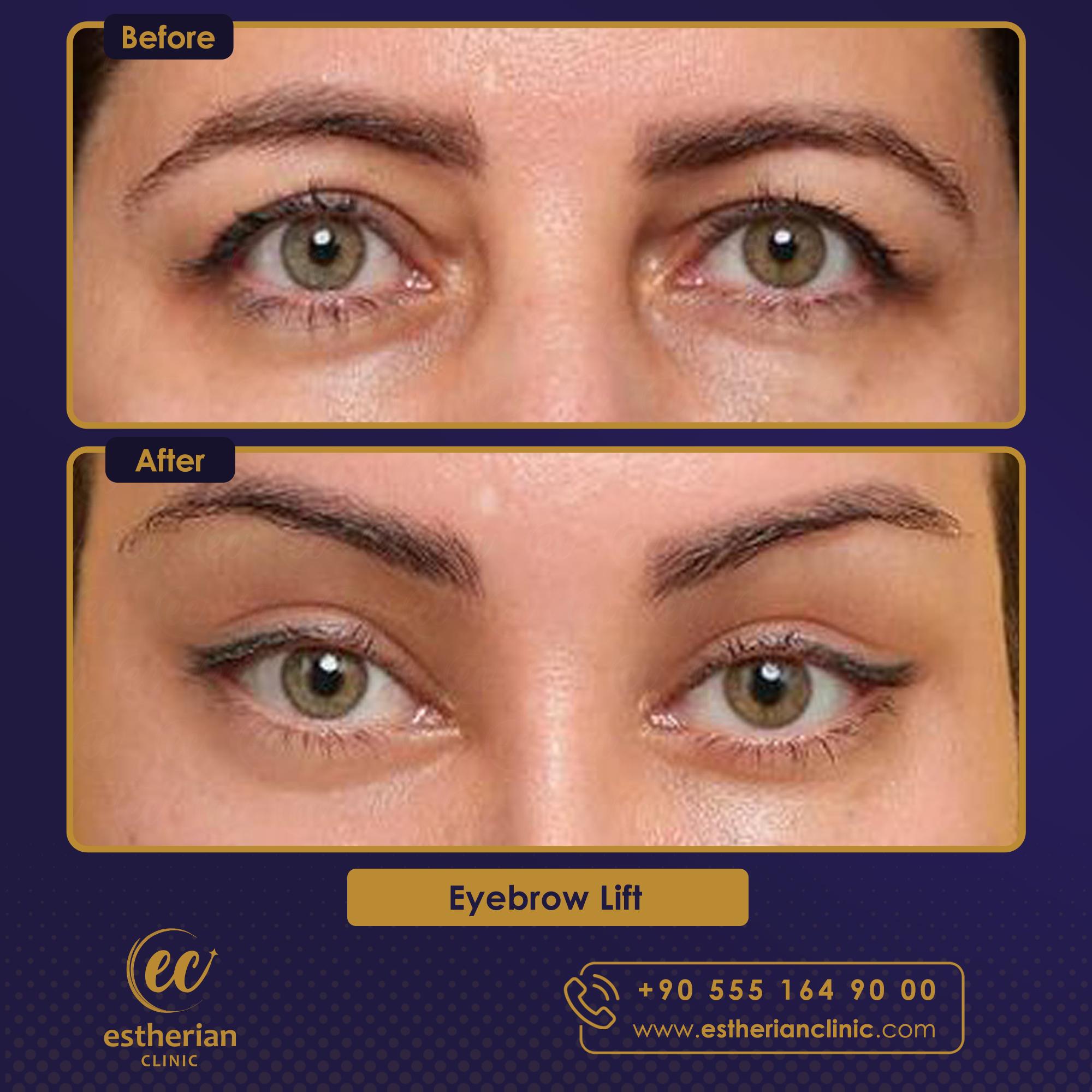 Estherian Istanbul on Esthetic Planet