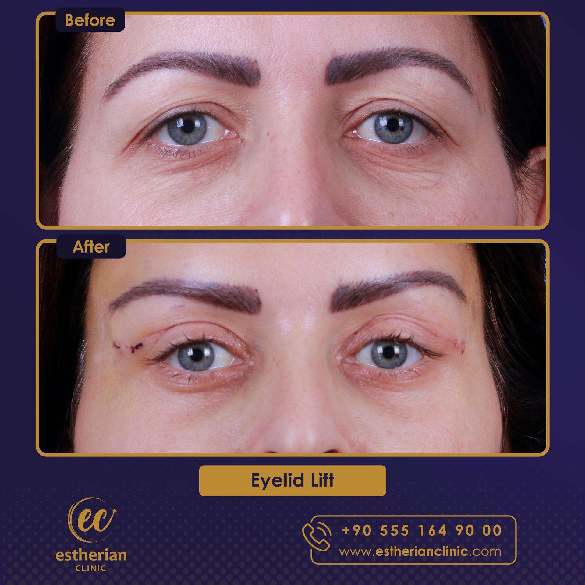 Estherian Istanbul on Esthetic Planet