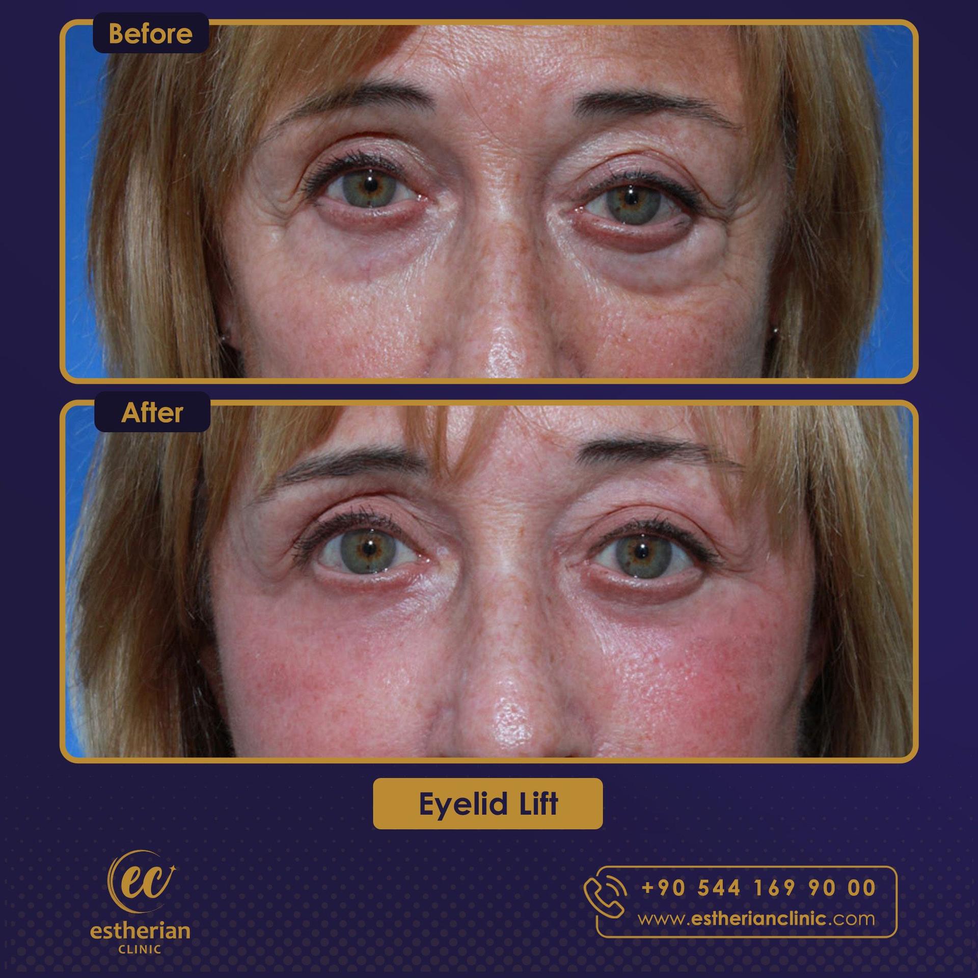 Estherian Istanbul on Esthetic Planet