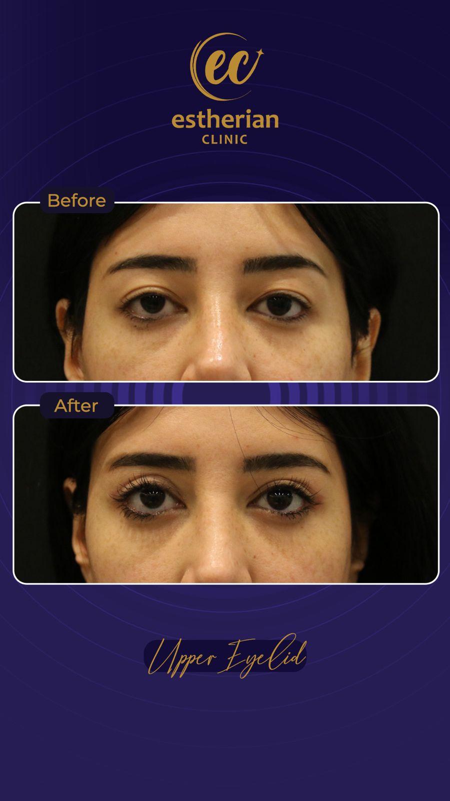 IMG-Estherian Istanbul on Esthetic Planet-WA0022