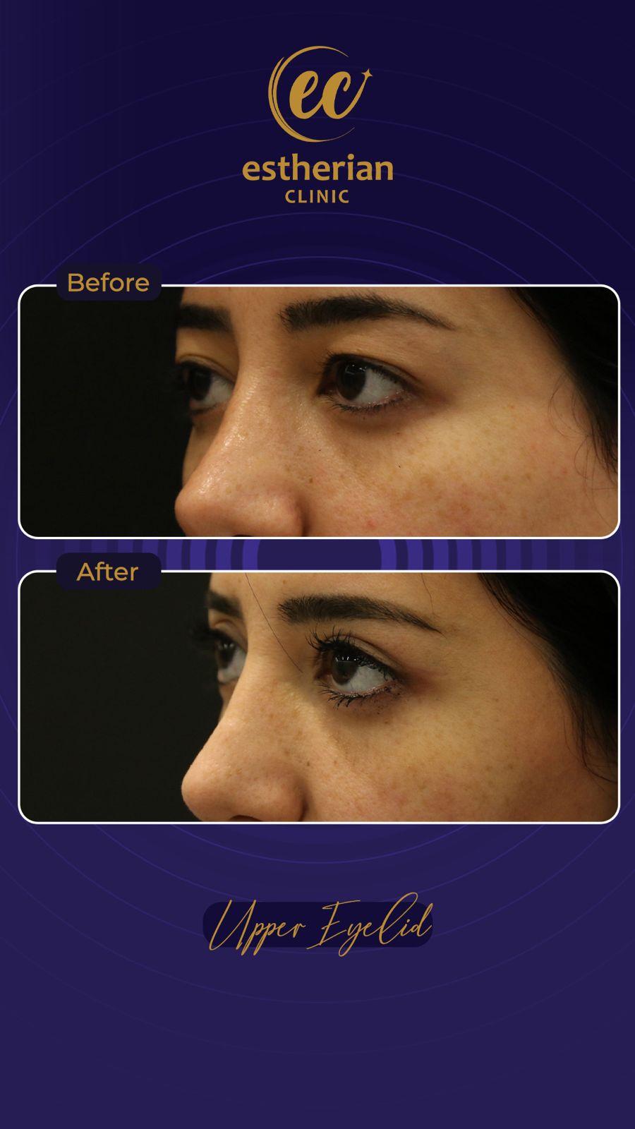 Estherian Istanbul on Esthetic Planet