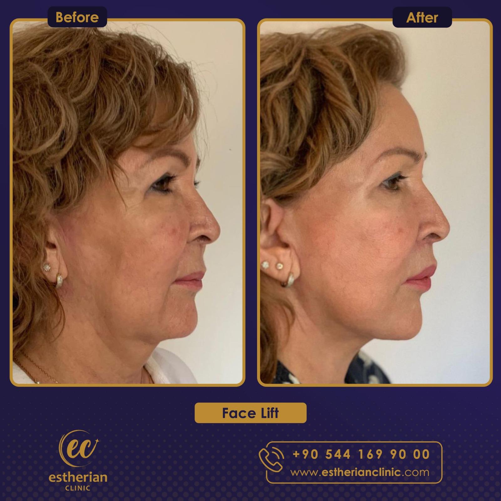 Estherian Istanbul on Esthetic Planet