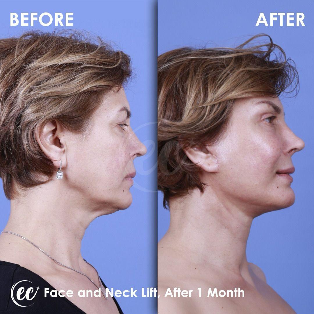 Estherian Istanbul on Esthetic Planet