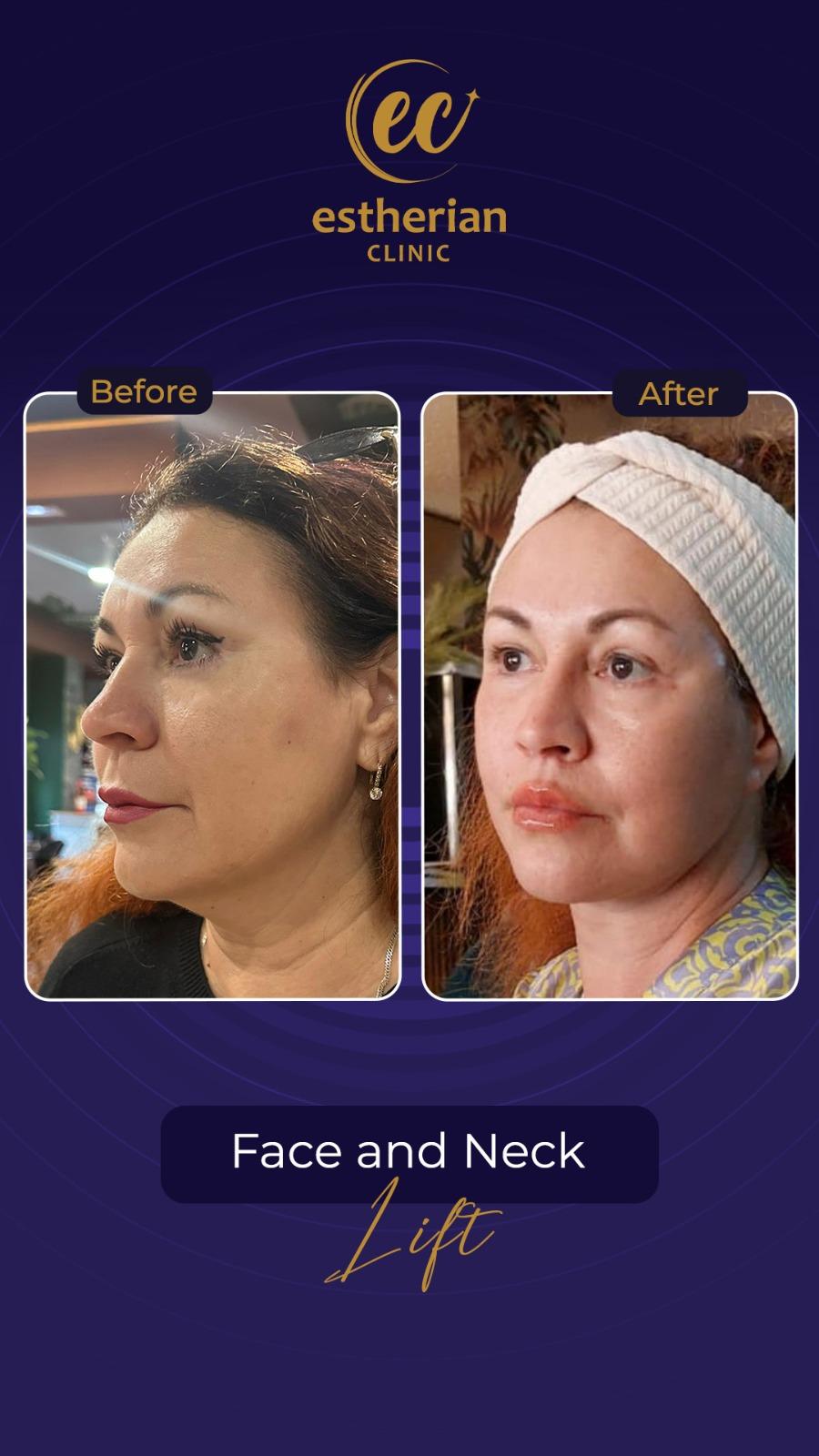 Estherian Istanbul on Esthetic Planet