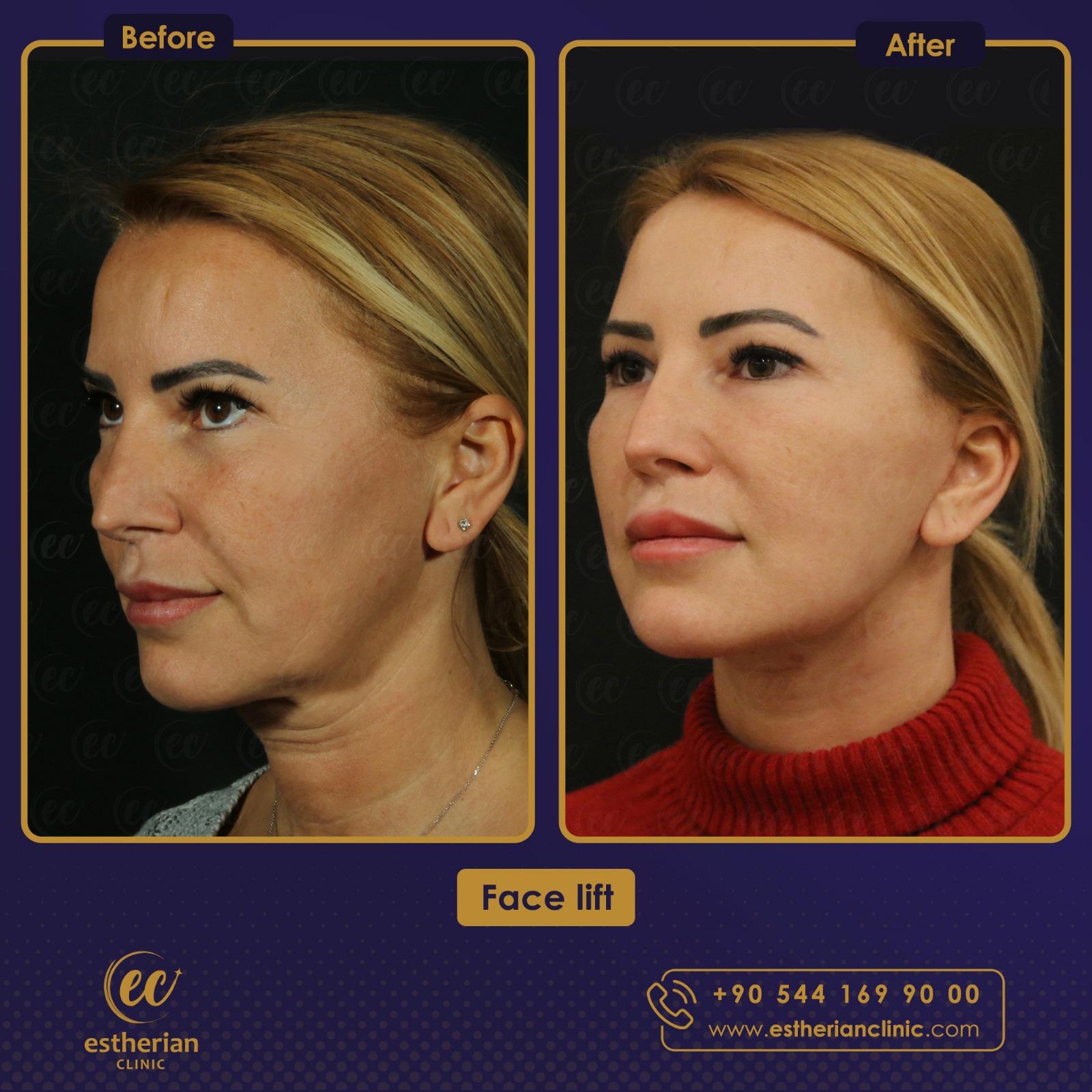 Estherian Istanbul on Esthetic Planet