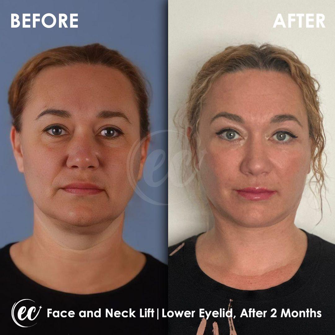 Estherian Istanbul on Esthetic Planet