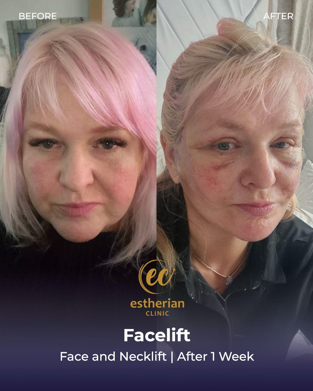 Estherian Istanbul on Esthetic Planet