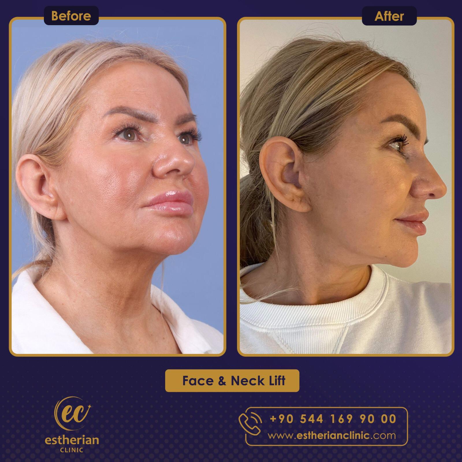 Estherian Istanbul on Esthetic Planet