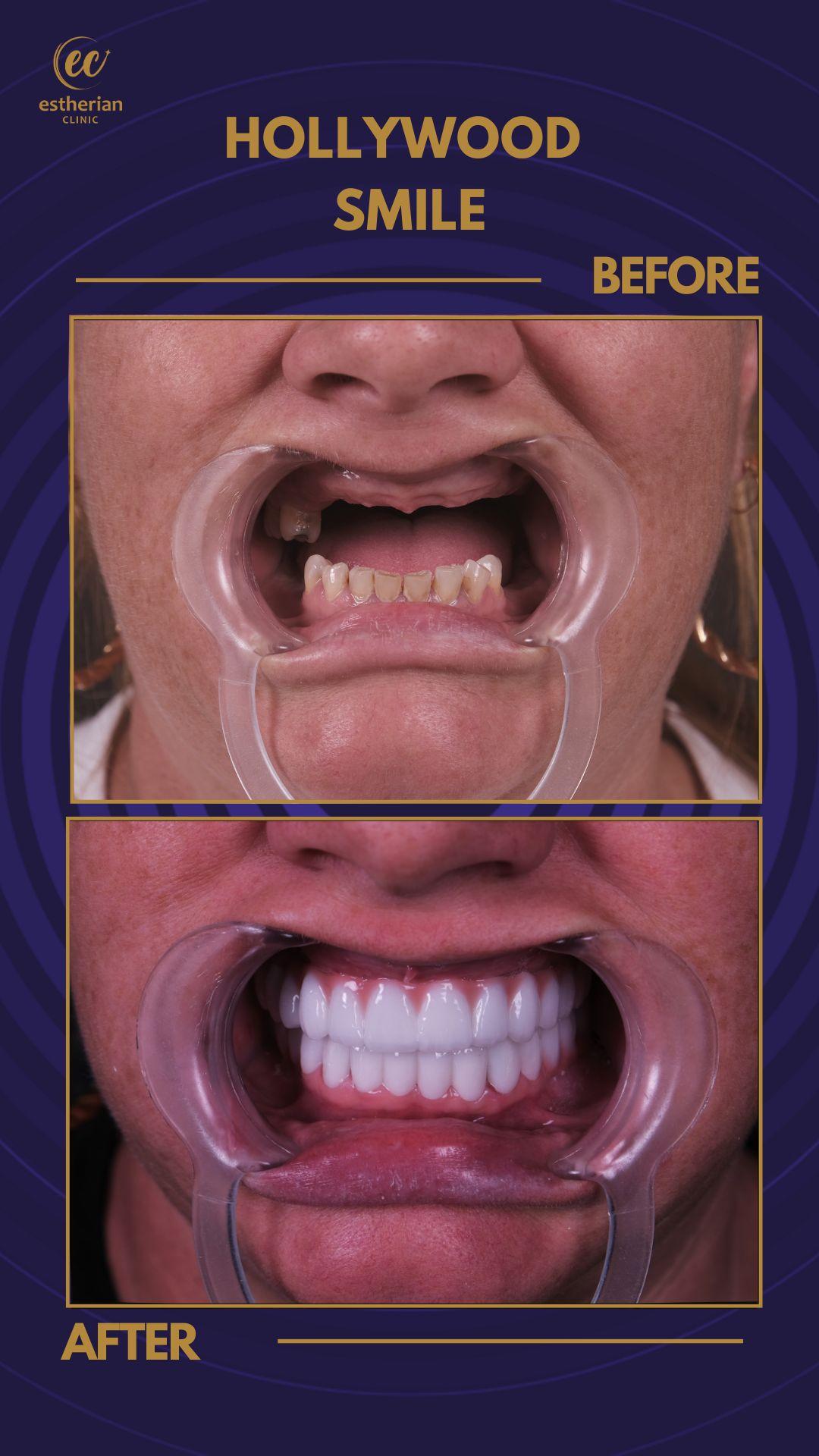 Estherian Istanbul on Esthetic Planet