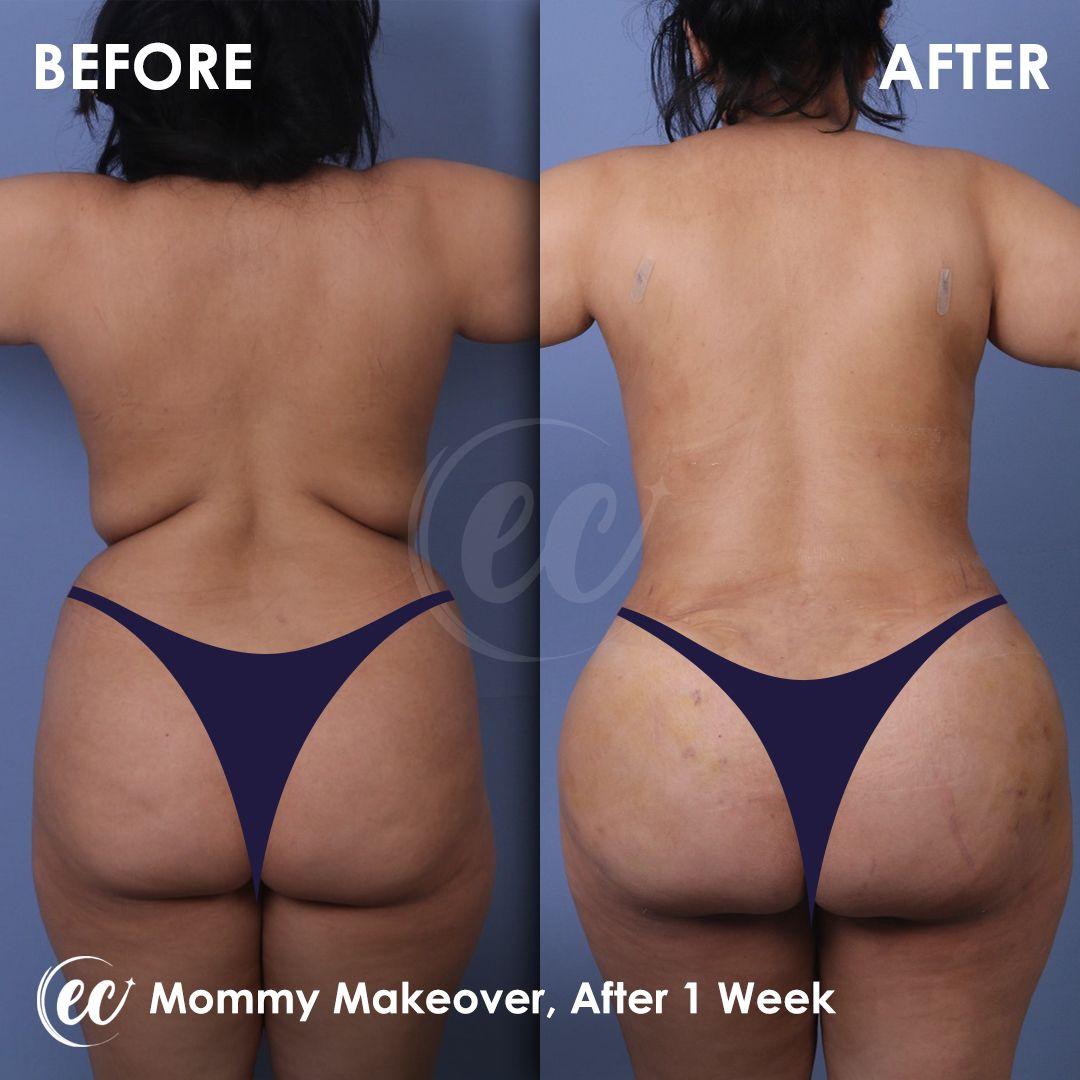 Estherian Istanbul on Esthetic Planet