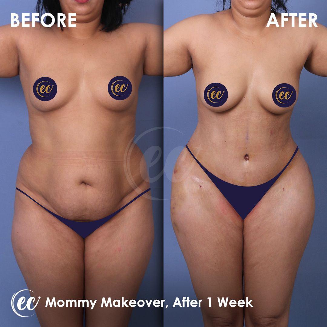 Estherian Istanbul on Esthetic Planet