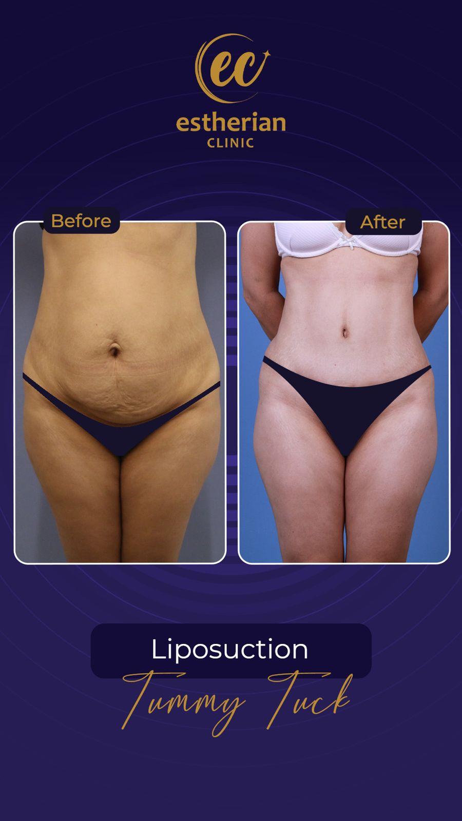 Estherian Istanbul on Esthetic Planet