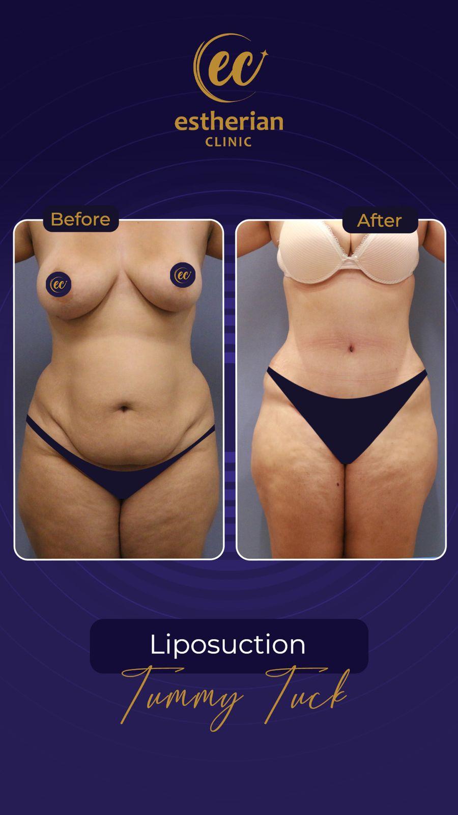 Estherian Istanbul on Esthetic Planet