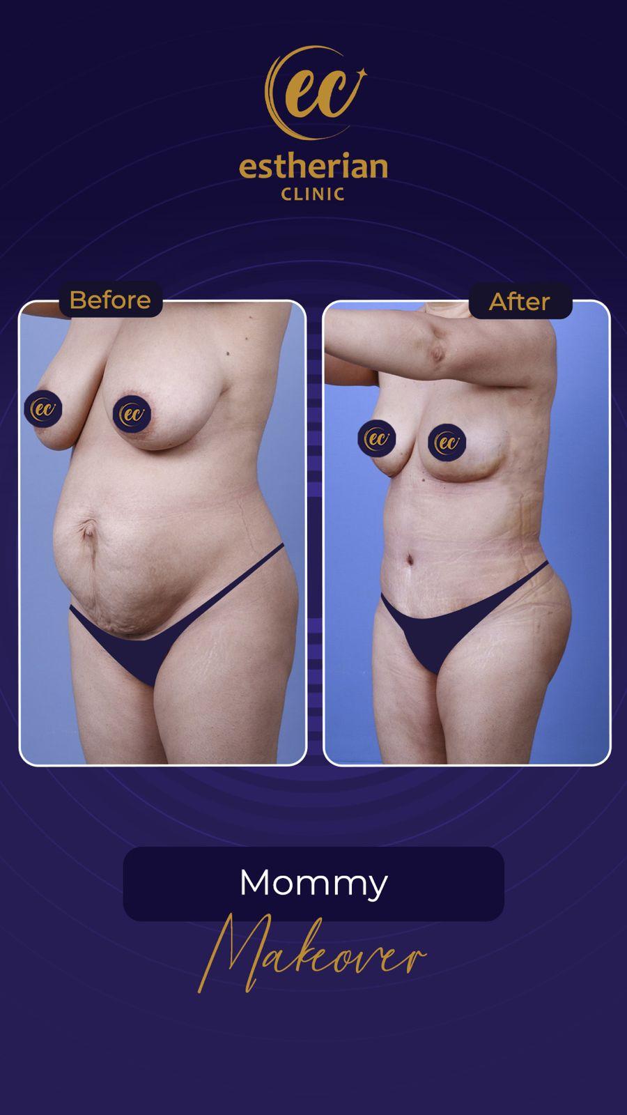 Estherian Istanbul on Esthetic Planet