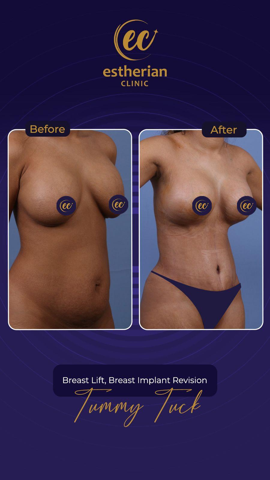 Estherian Istanbul on Esthetic Planet