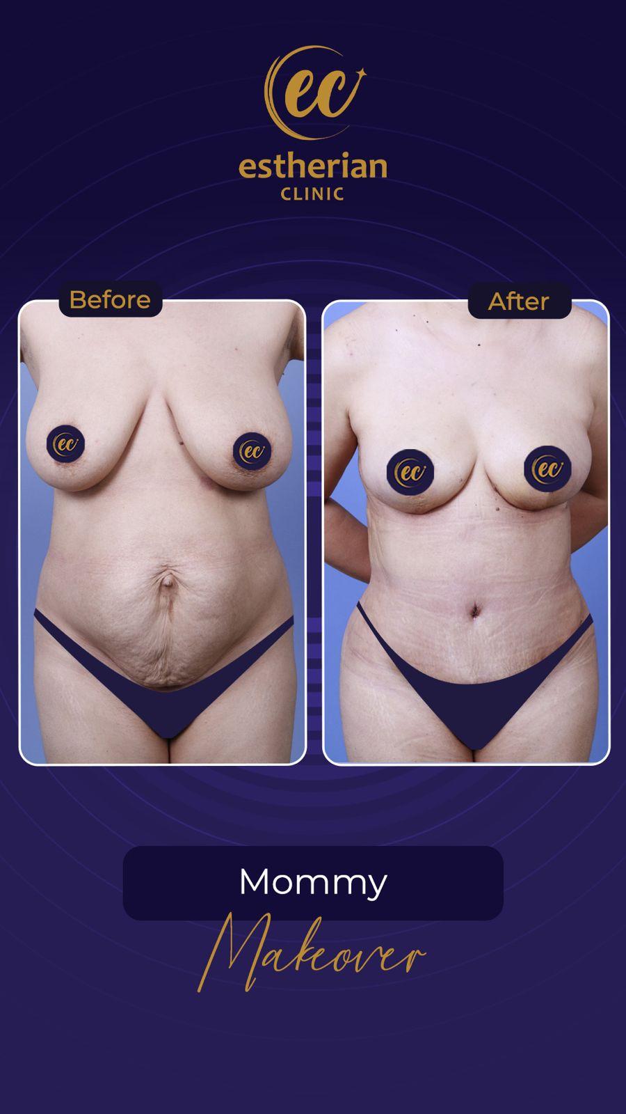 Estherian Istanbul on Esthetic Planet