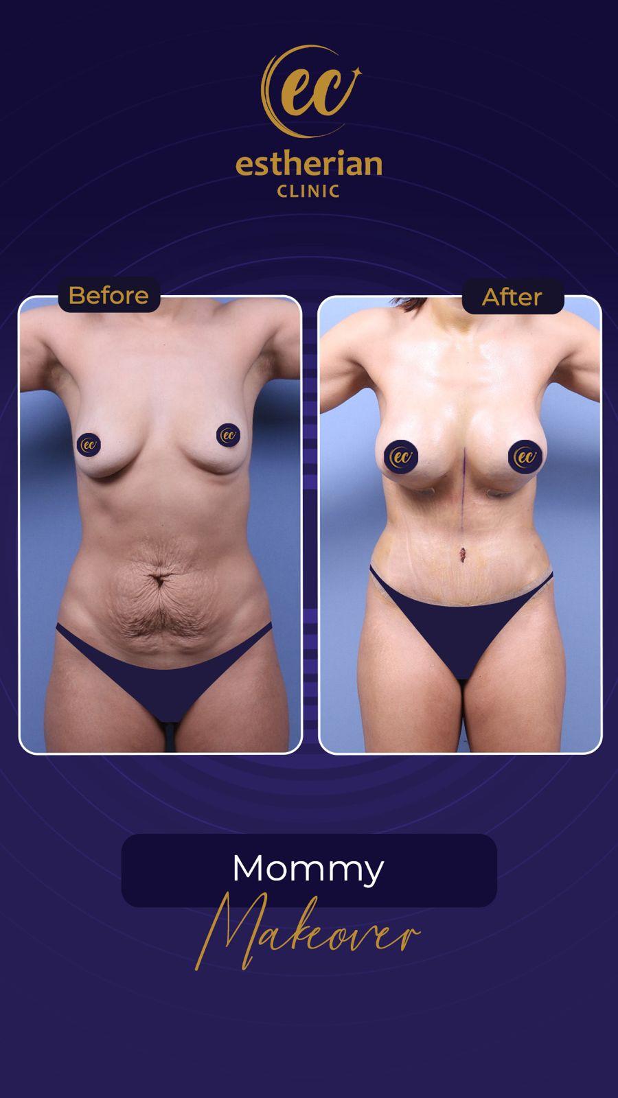 Estherian Istanbul on Esthetic Planet