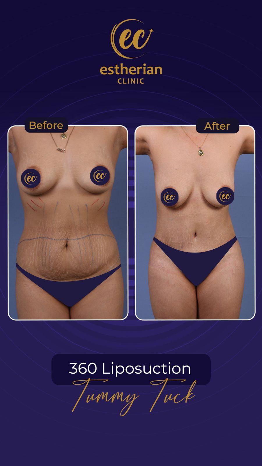 Estherian Istanbul on Esthetic Planet