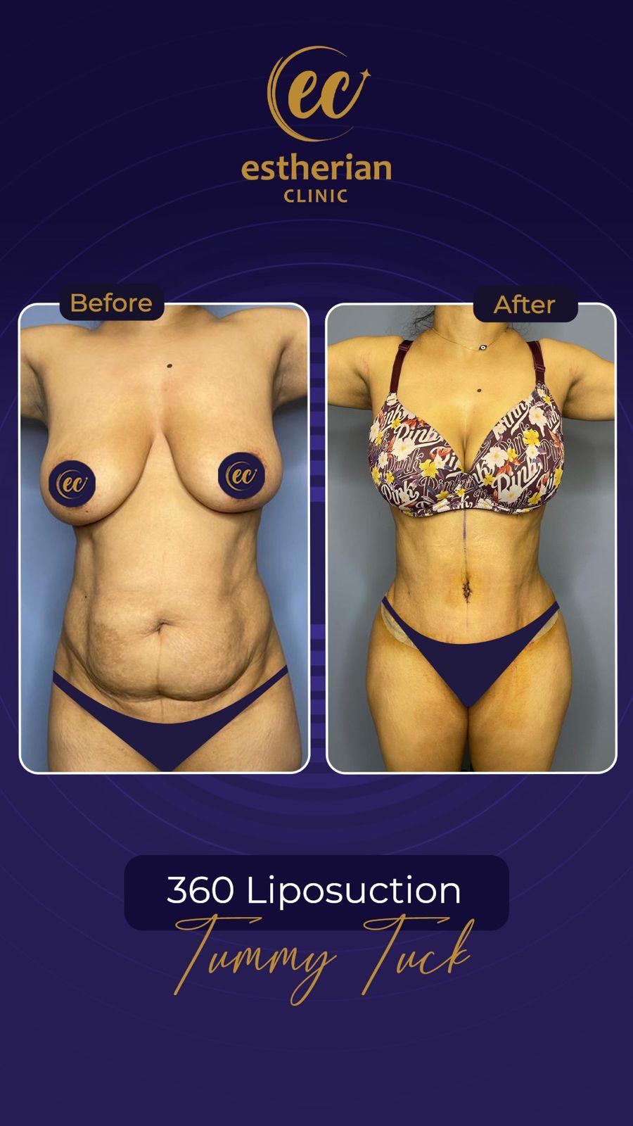 Estherian Istanbul on Esthetic Planet