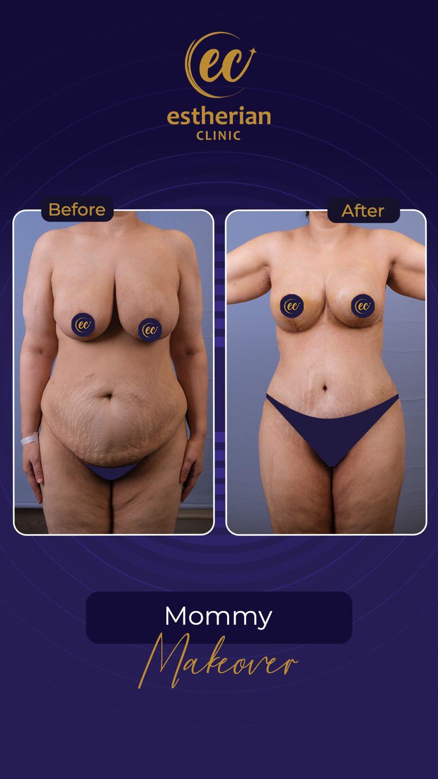 Estherian Istanbul on Esthetic Planet