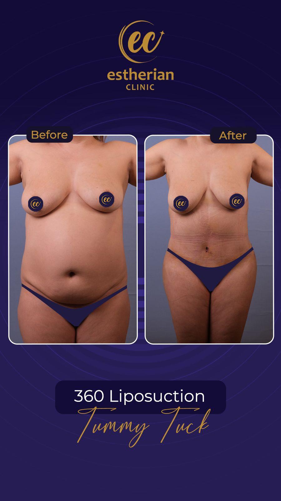 Estherian Istanbul on Esthetic Planet