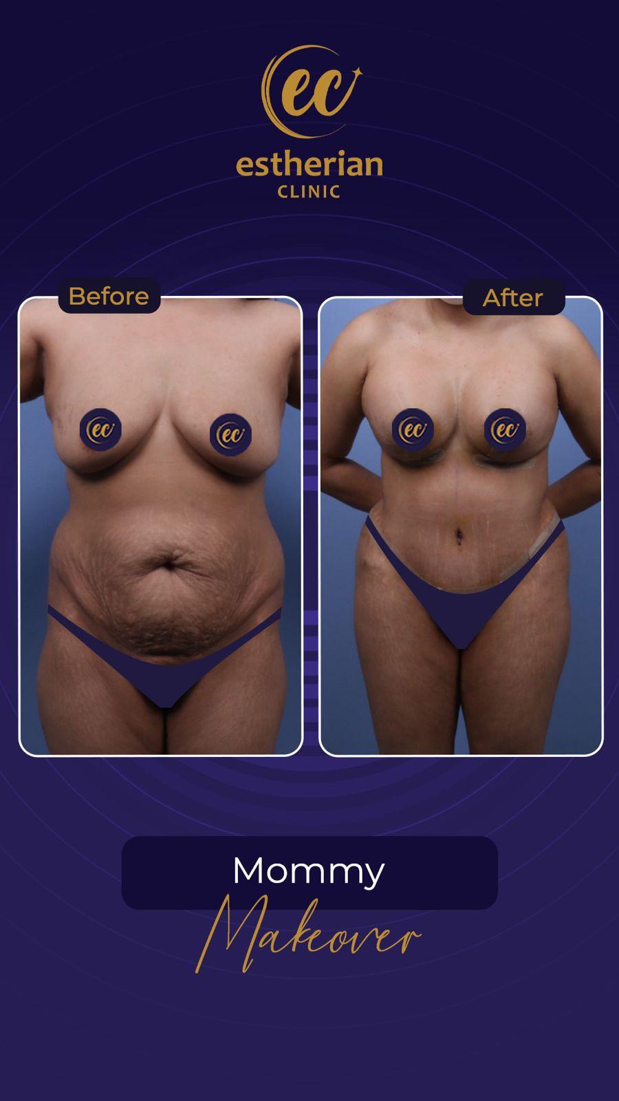 Estherian Istanbul on Esthetic Planet