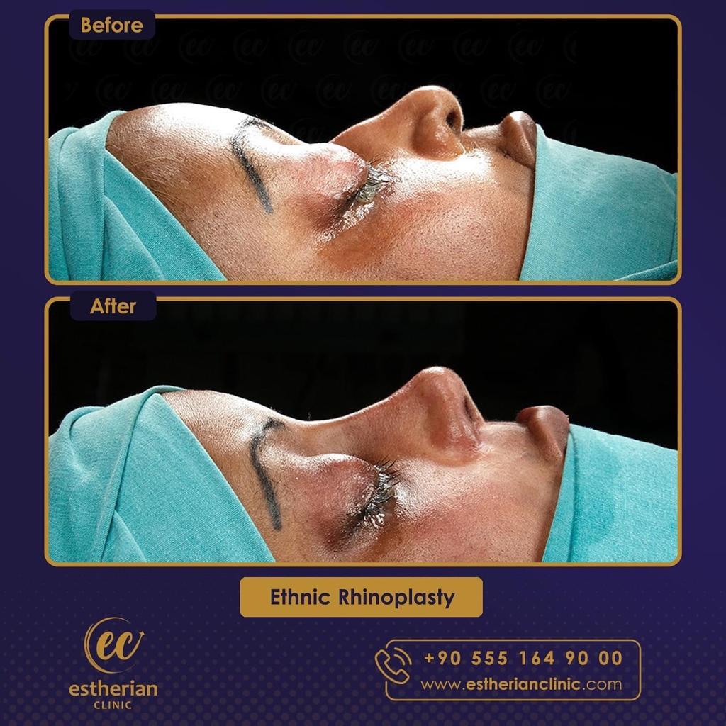 Estherian Istanbul on Esthetic Planet