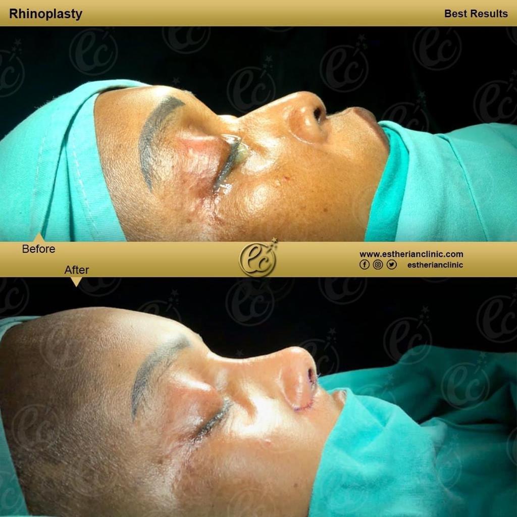 Estherian Istanbul on Esthetic Planet