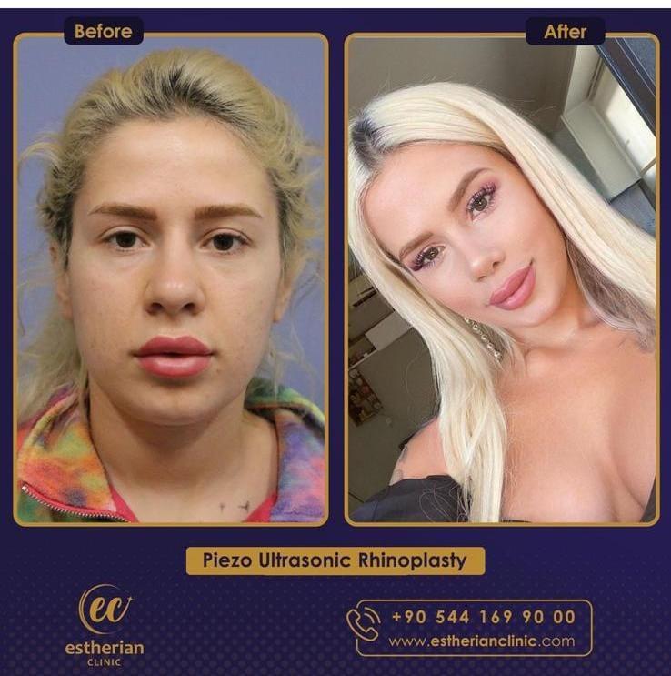 Estherian Istanbul on Esthetic Planet