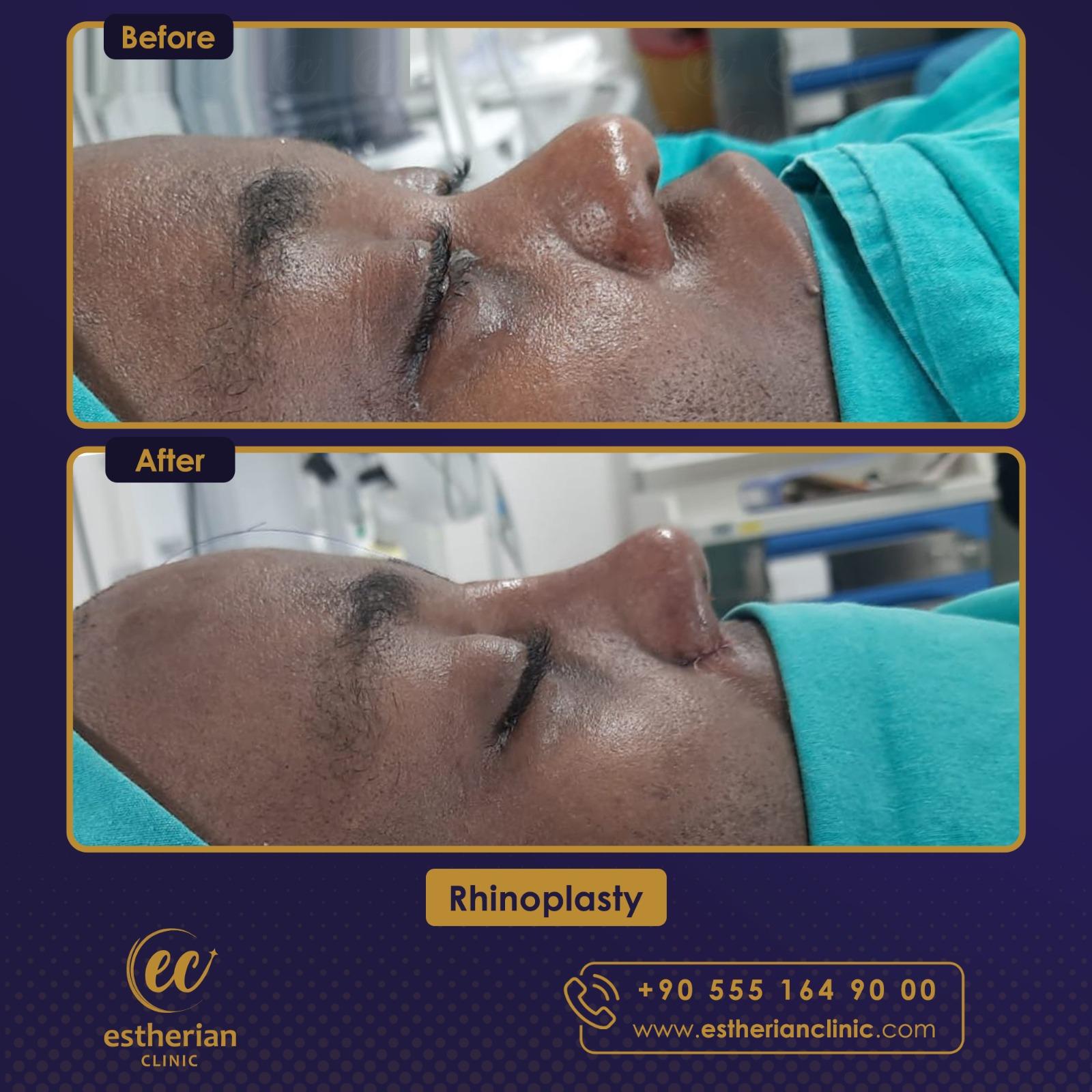 Estherian Istanbul on Esthetic Planet