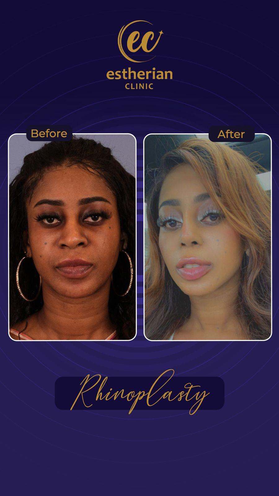 Estherian Istanbul on Esthetic Planet