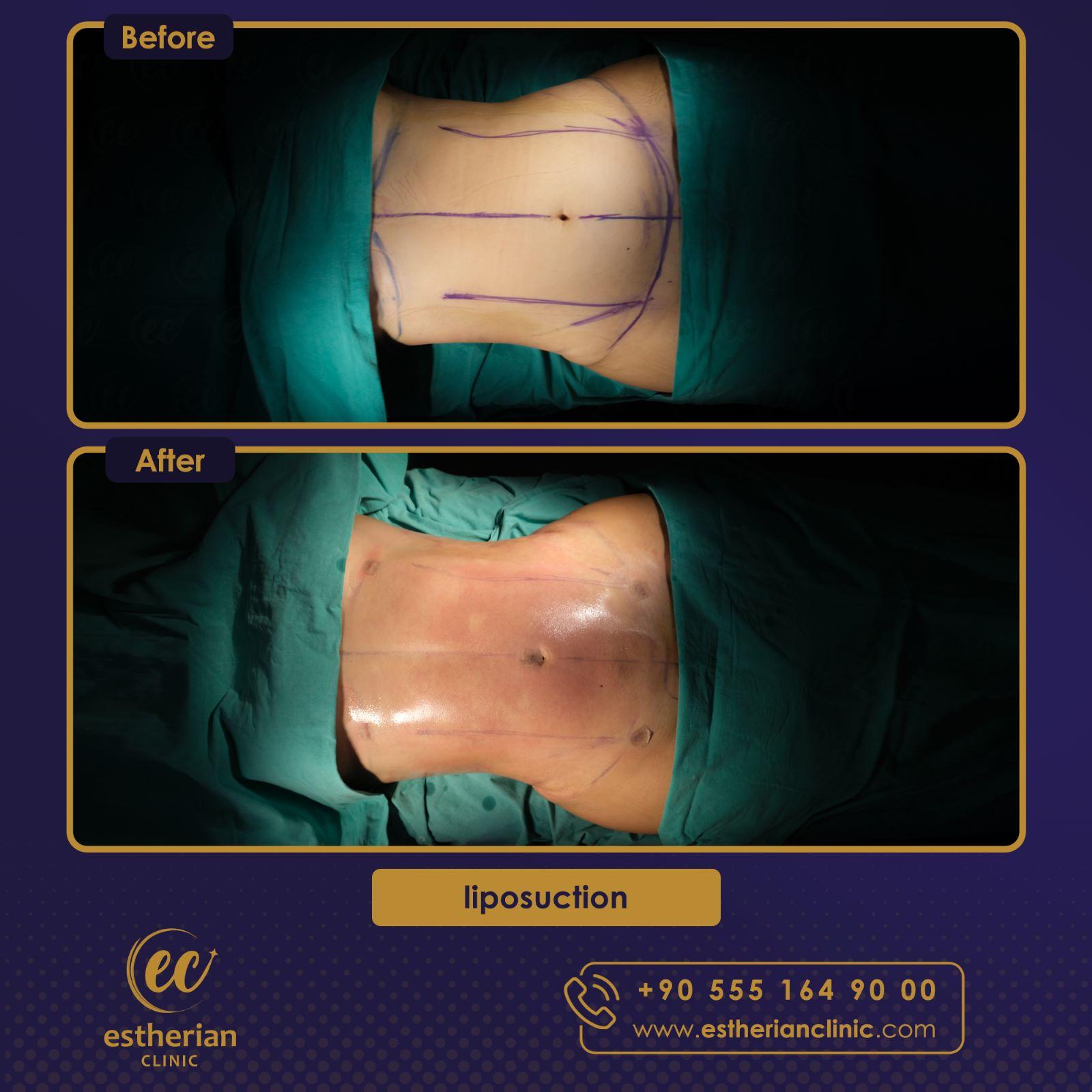 Estherian Istanbul on Esthetic Planet