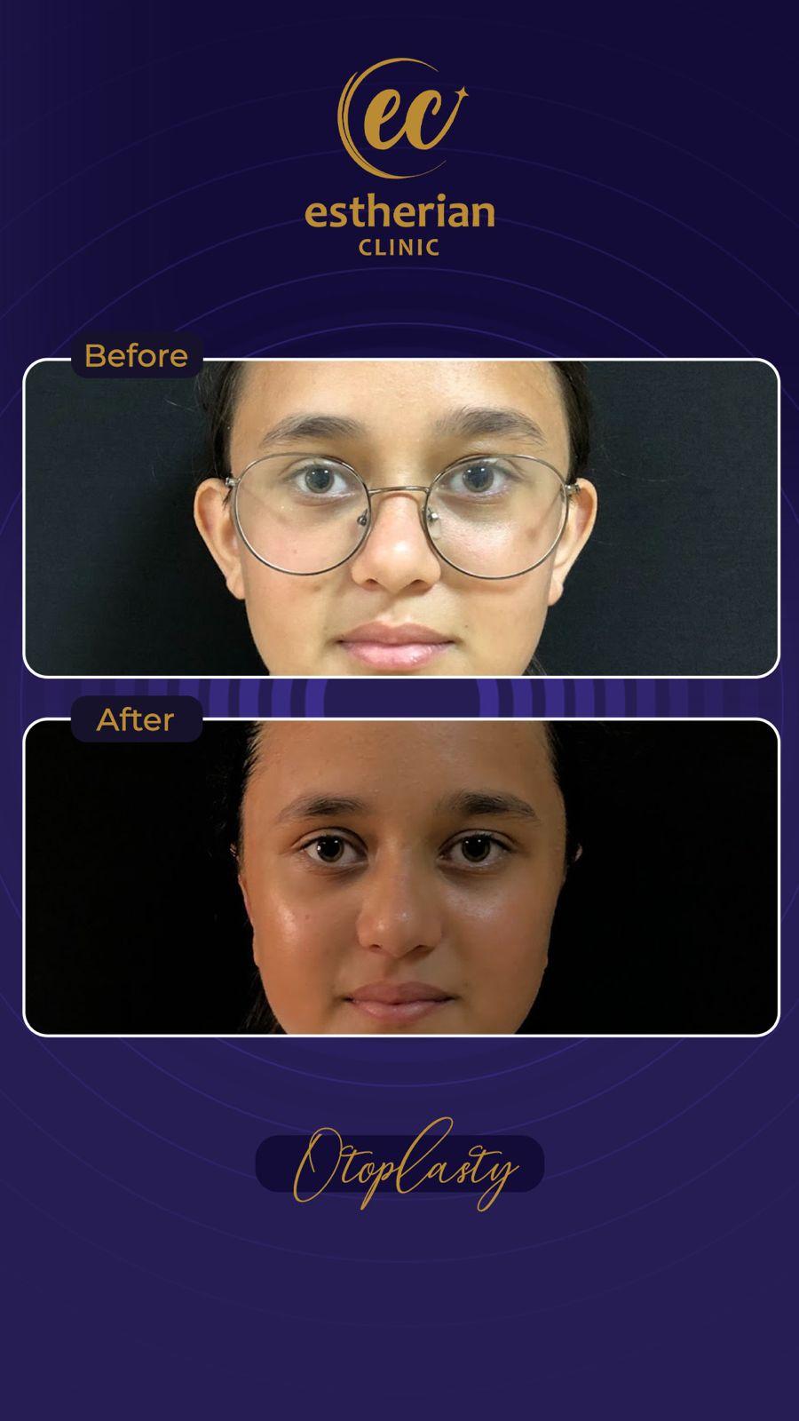 Estherian Istanbul on Esthetic Planet