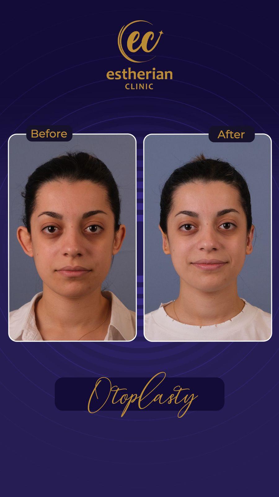 Estherian Istanbul on Esthetic Planet