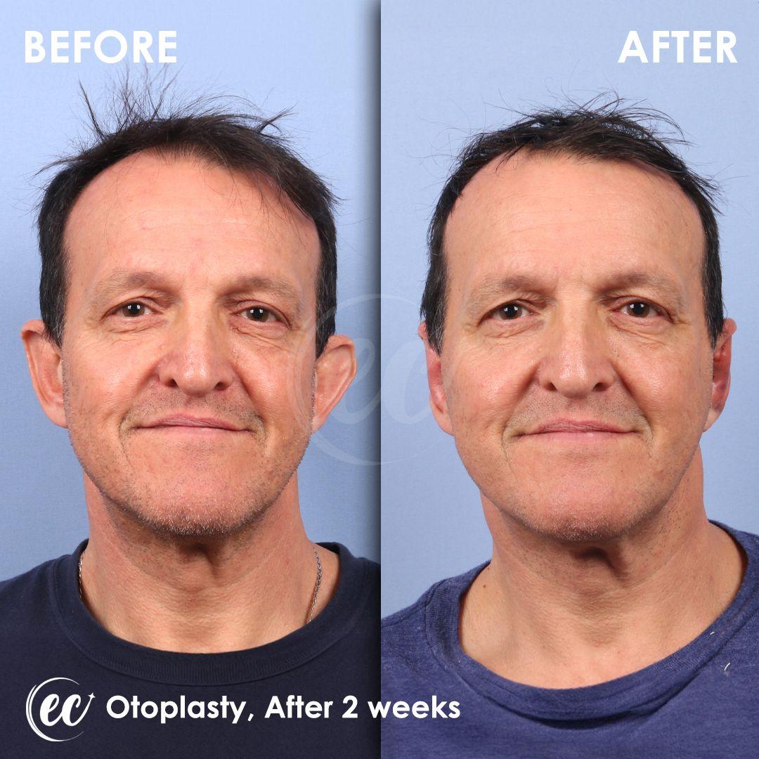 Estherian Istanbul on Esthetic Planet