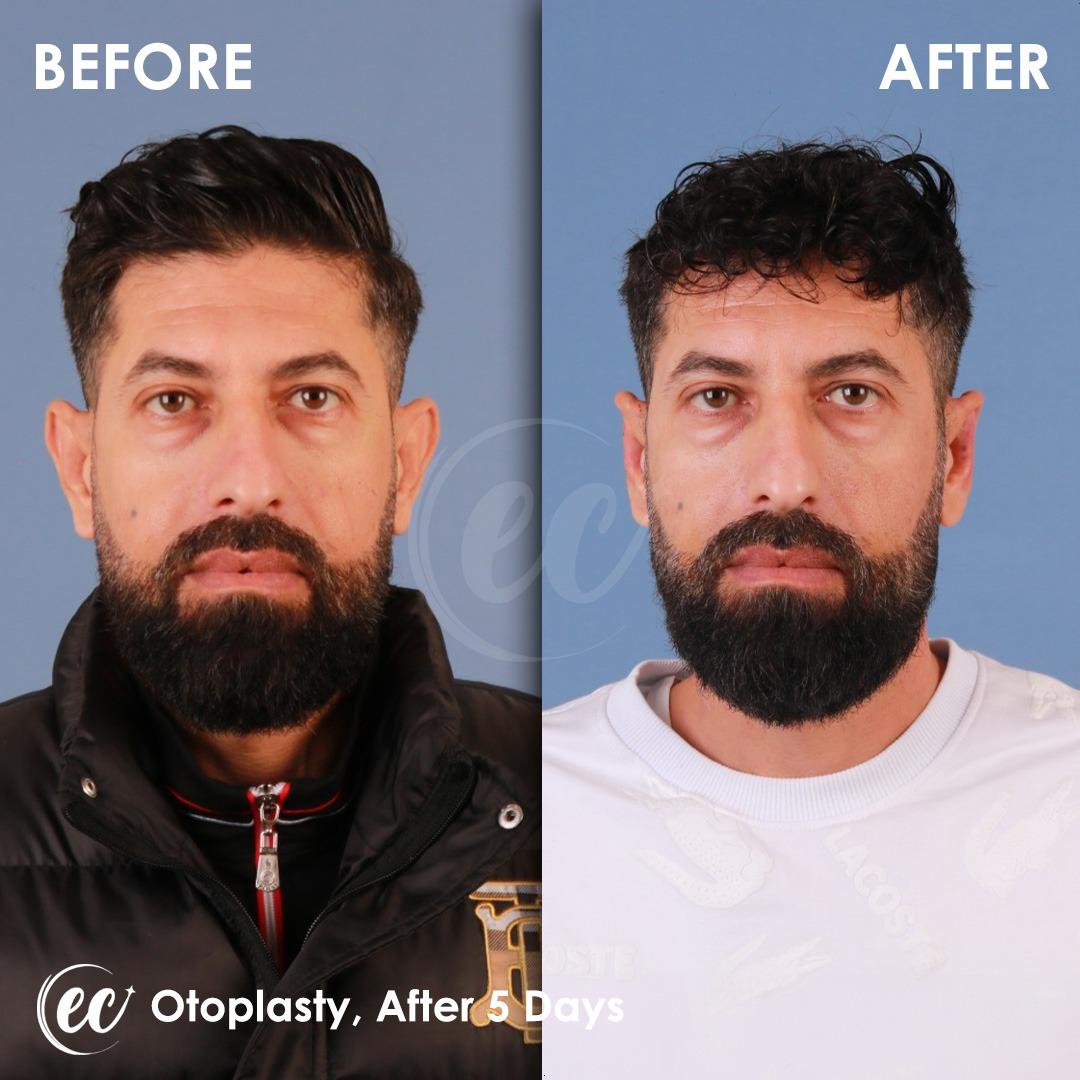 Estherian Istanbul on Esthetic Planet