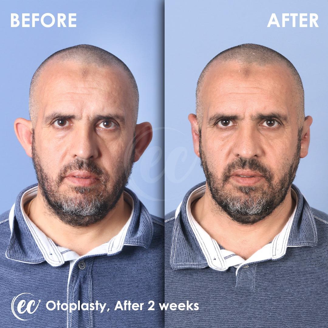 Estherian Istanbul on Esthetic Planet