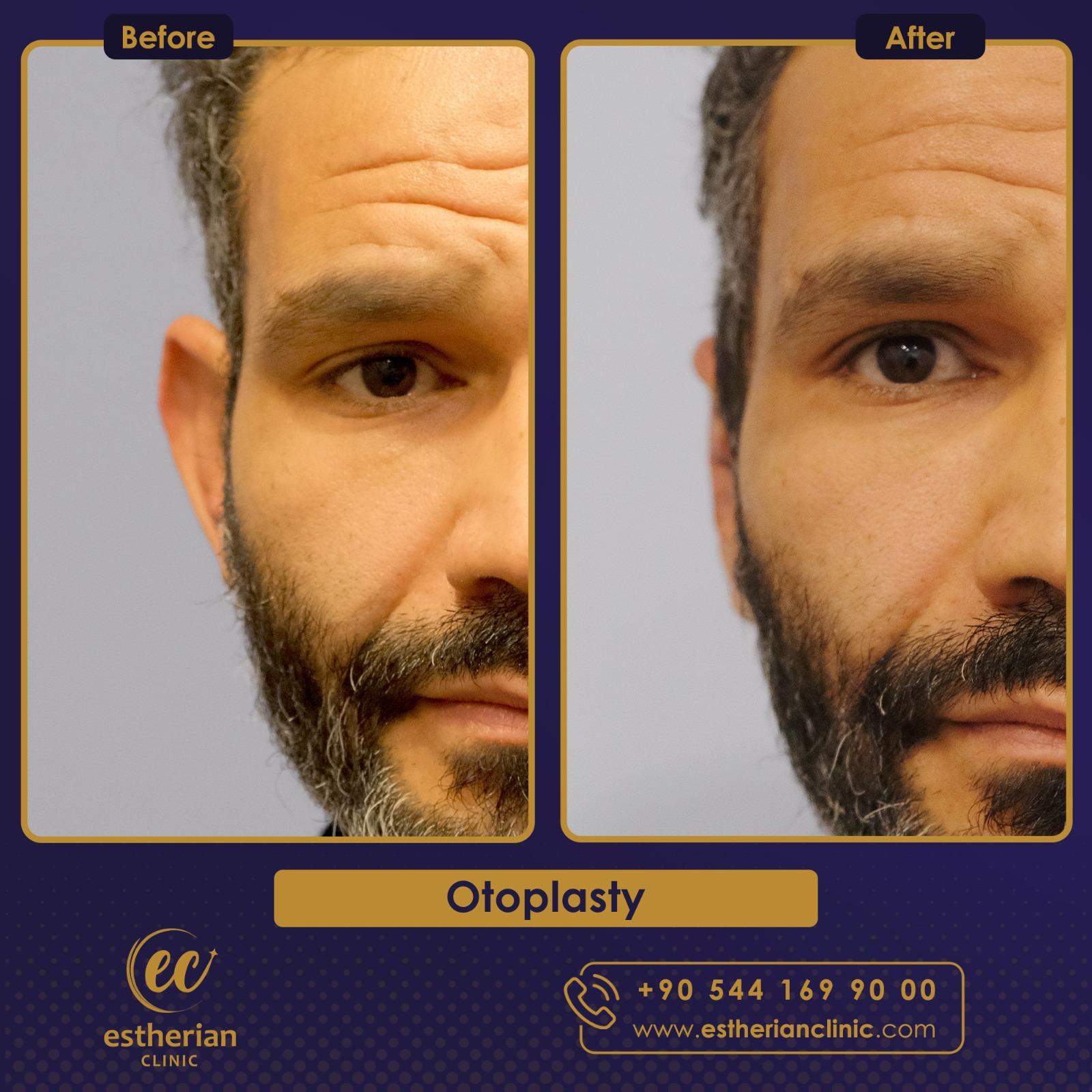 Estherian Istanbul on Esthetic Planet