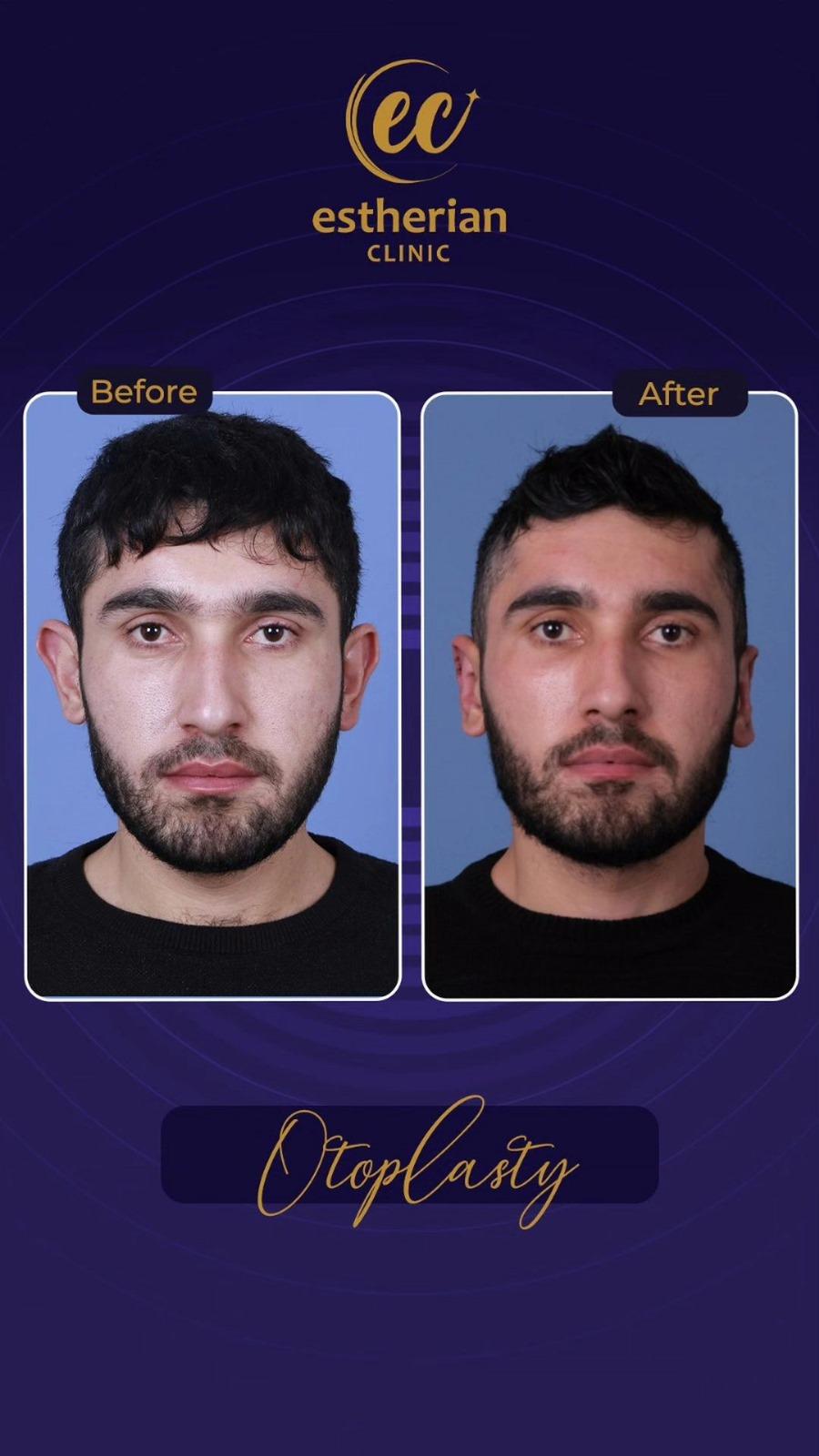 Estherian Istanbul on Esthetic Planet