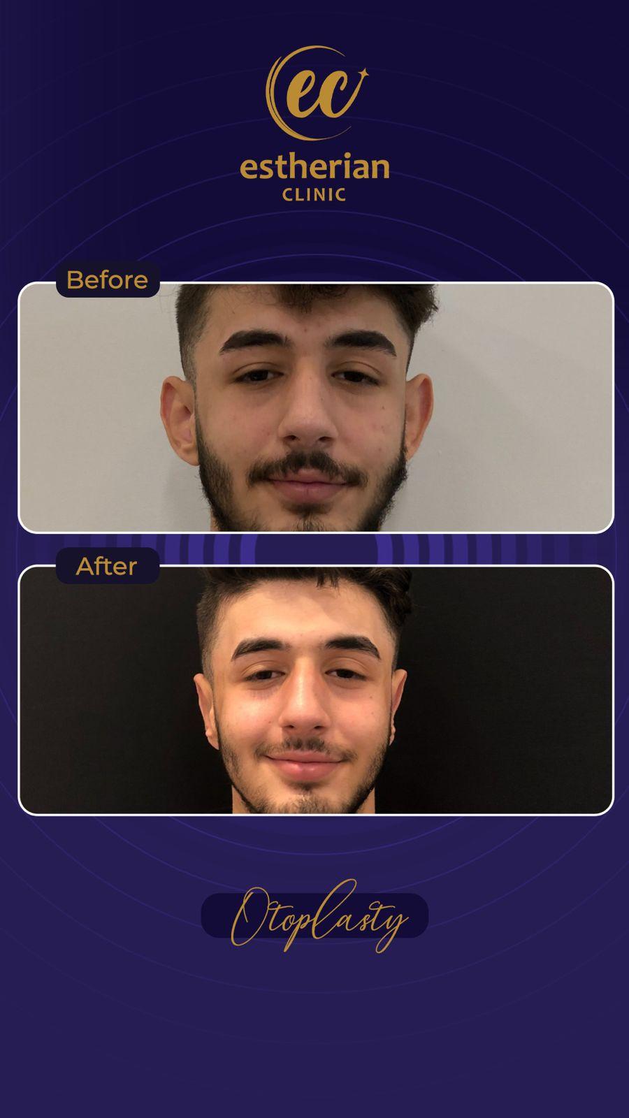 Estherian Istanbul on Esthetic Planet