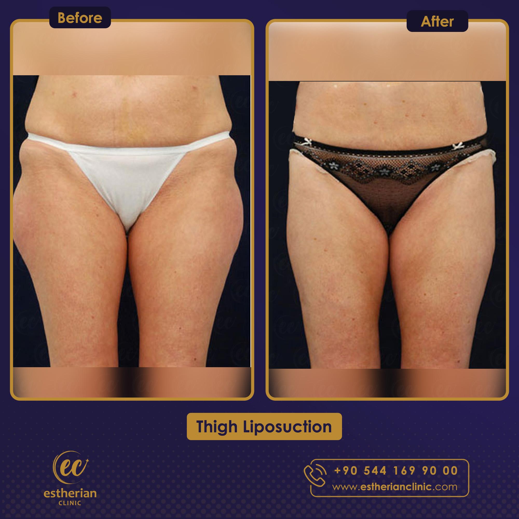 Estherian Istanbul on Esthetic Planet