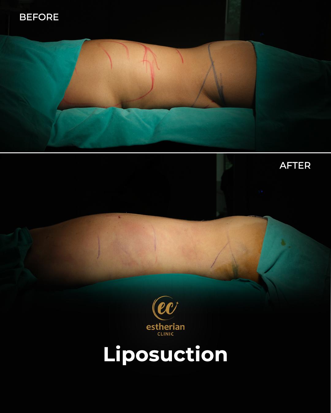 Estherian Istanbul on Esthetic Planet