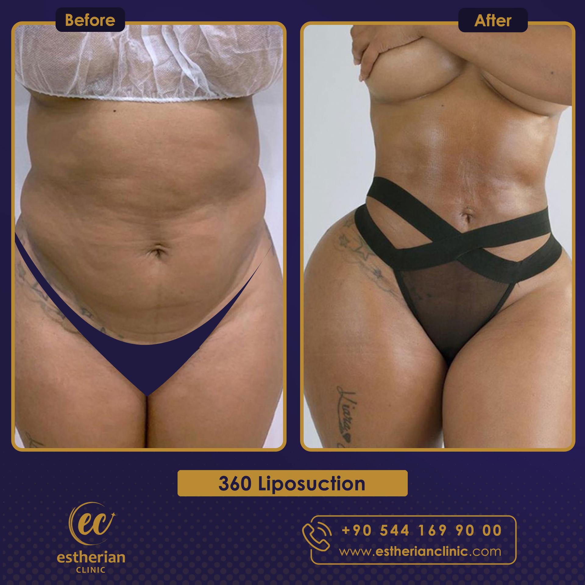 Estherian Istanbul on Esthetic Planet