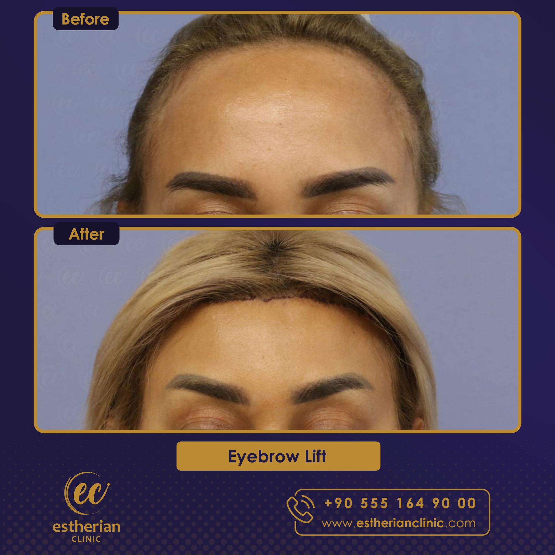 Estherian Istanbul on Esthetic Planet