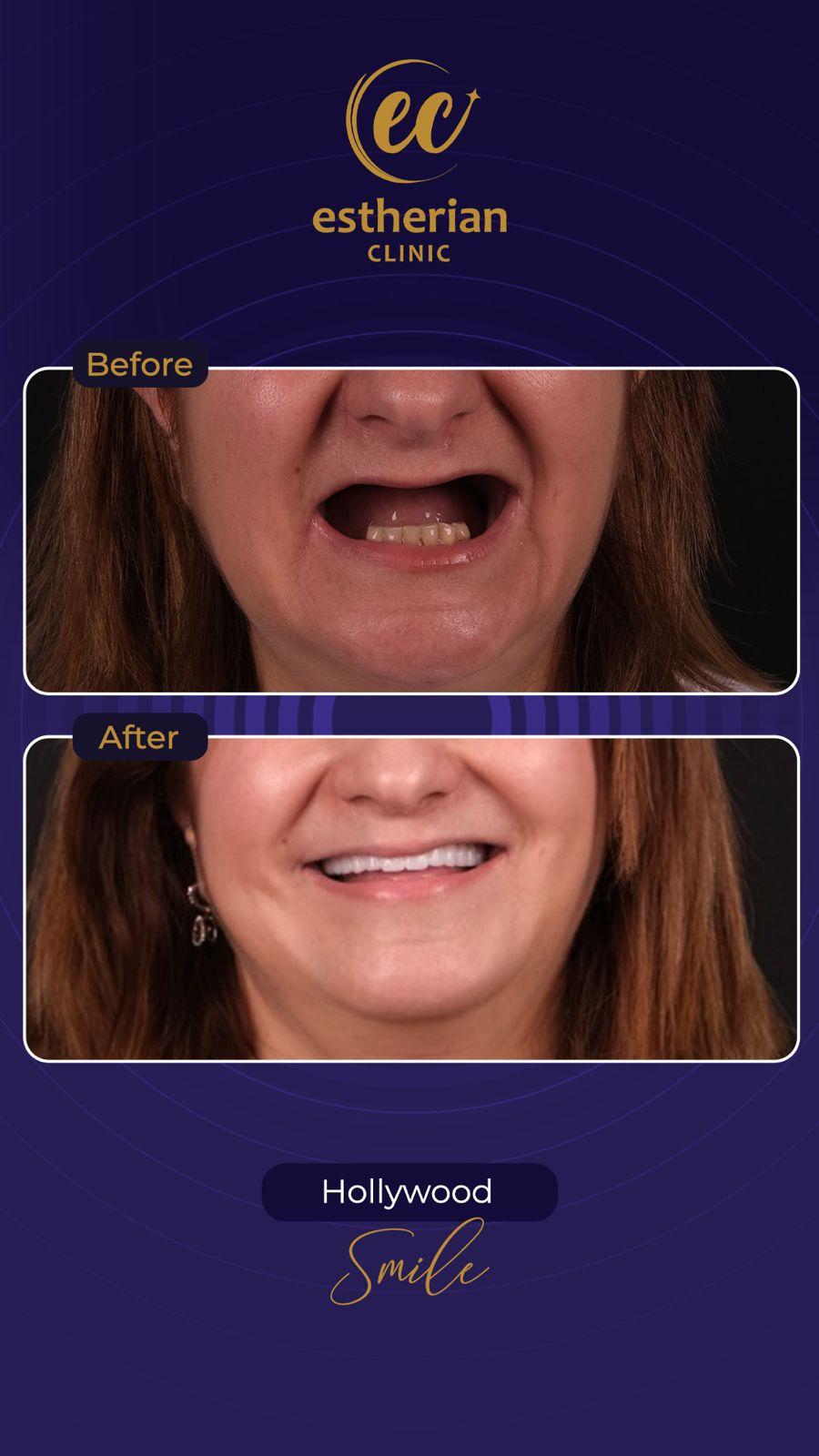 Estherian Istanbul on Esthetic Planet