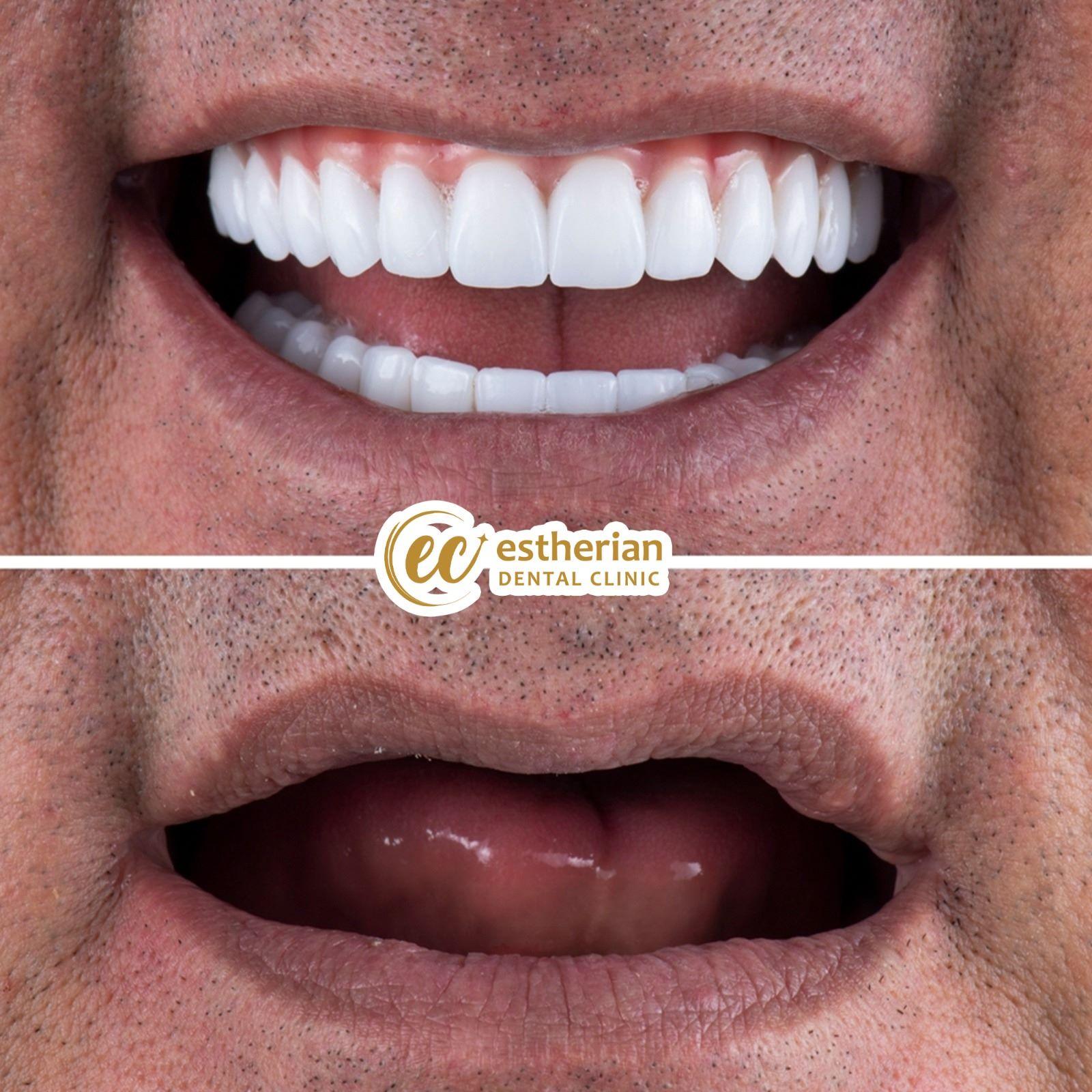 Estherian Istanbul on Esthetic Planet0230808-WA0154