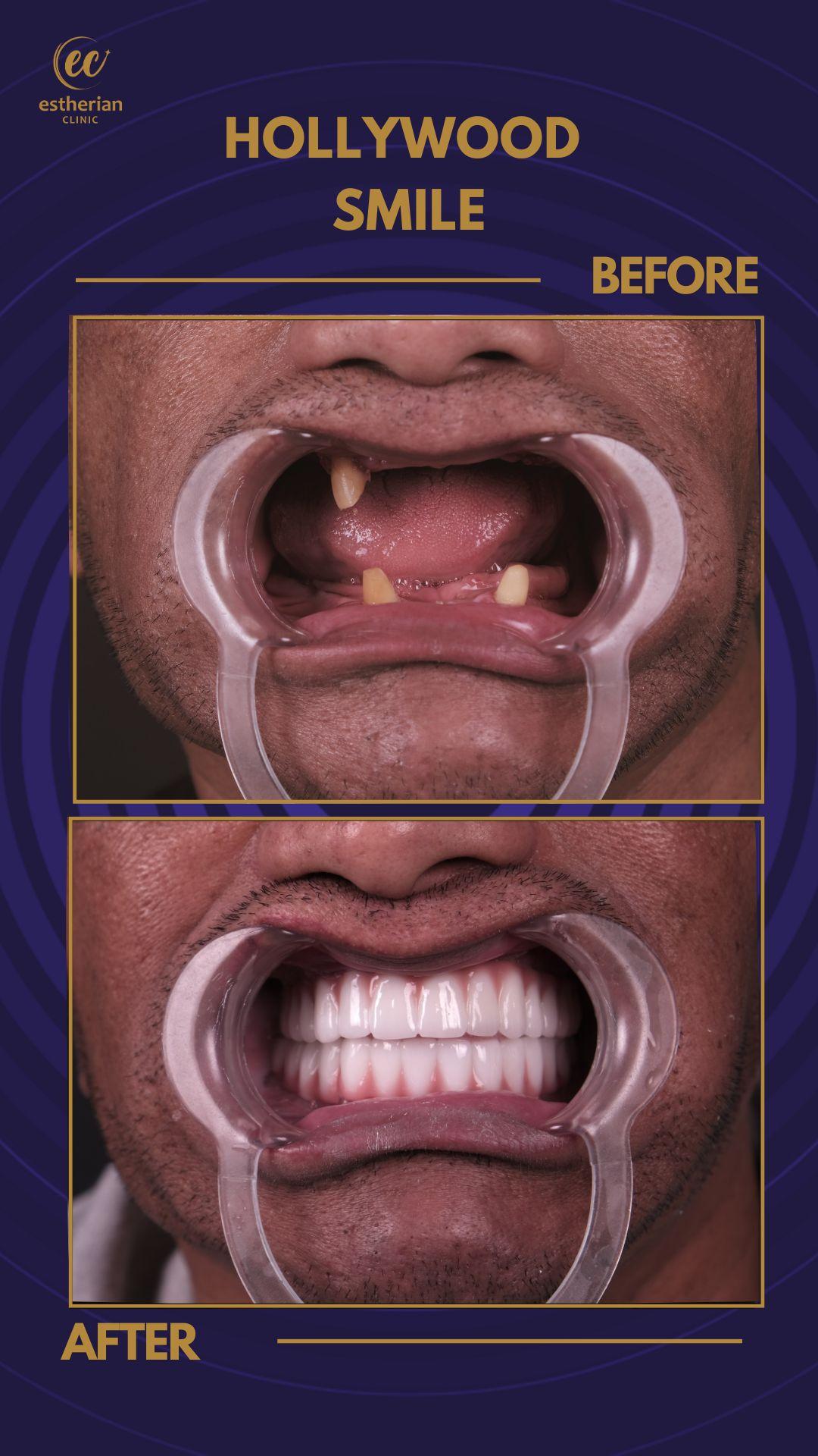 Estherian Istanbul on Esthetic Planet