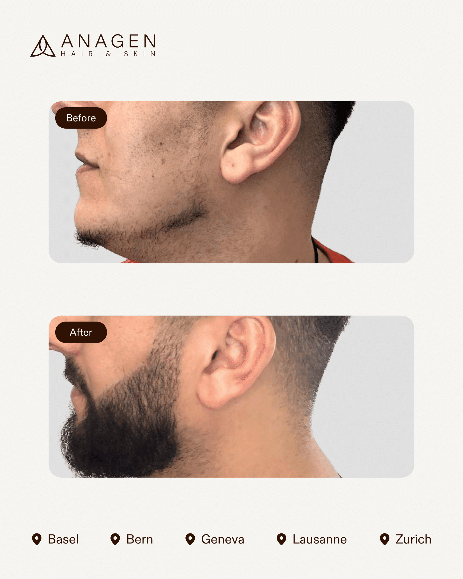 Anagen Clinic results