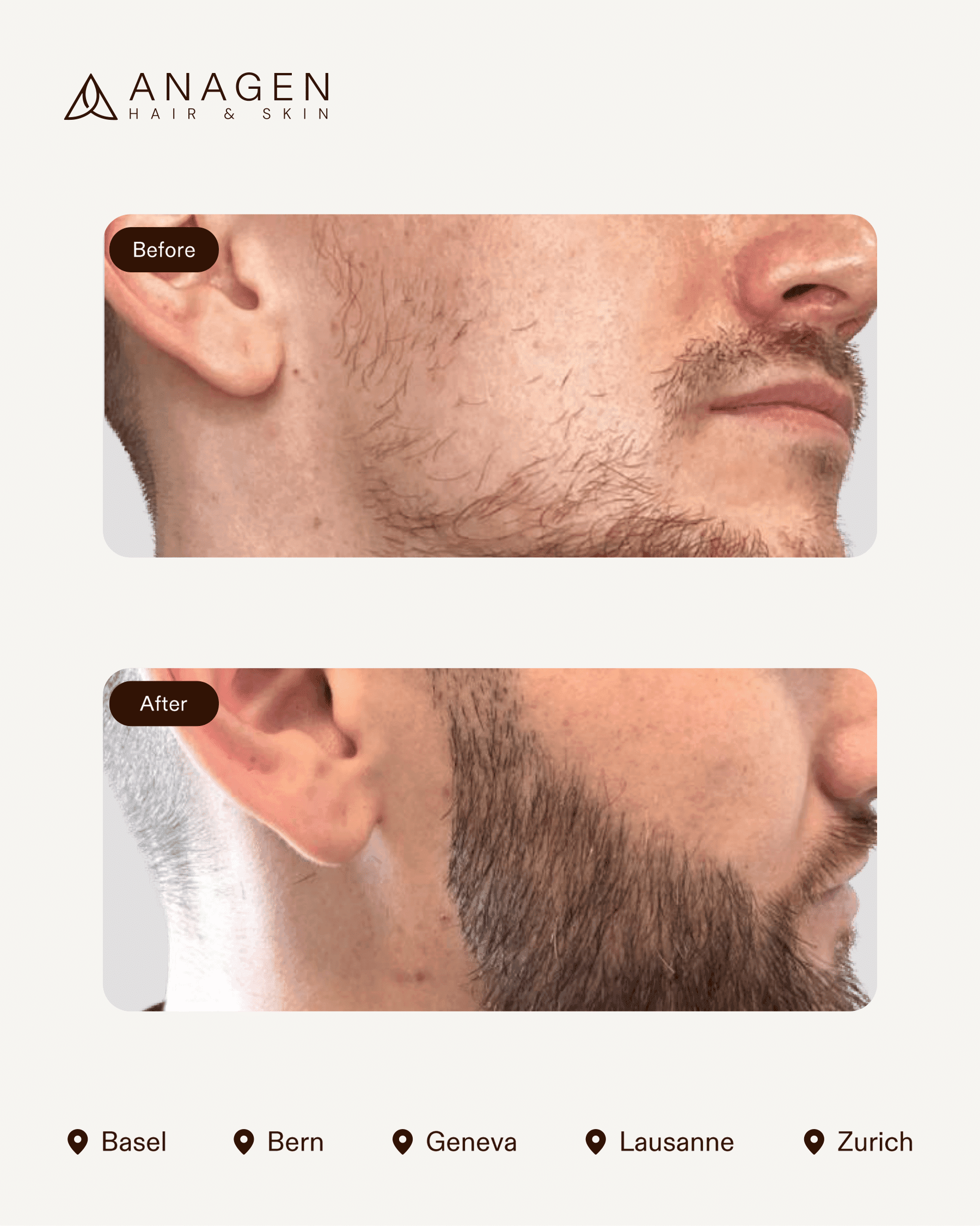 Anagen Clinic results